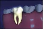Tooth with a healthy root Healthy Tooth